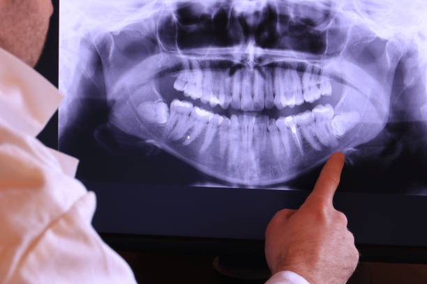 Best Emergency Dental Care for Broken or Chipped Teeth in Belen, NM